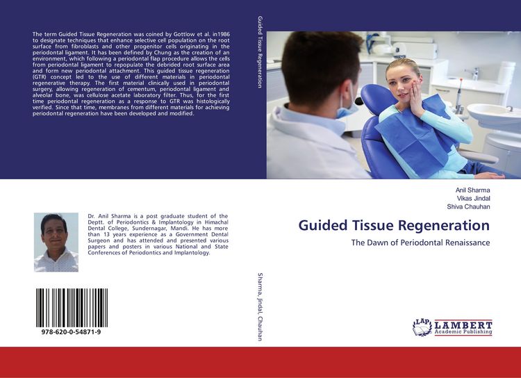 Produktbild: Guided Tissue Regeneration
