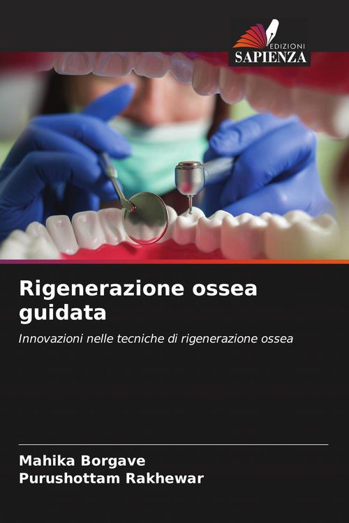 Produktbild: Rigenerazione ossea guidata