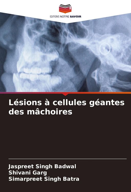 Produktbild: L&eacute;sions &agrave; cellules g&eacute;antes des m&acirc;choires