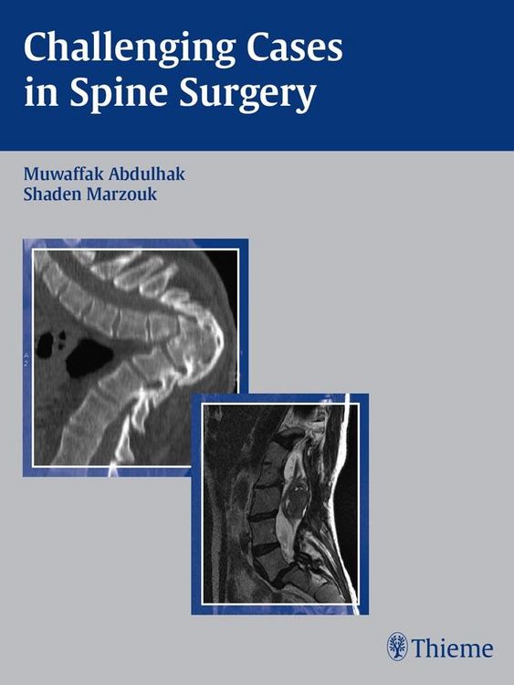 Produktbild: Challenging Cases in Spine Surgery
