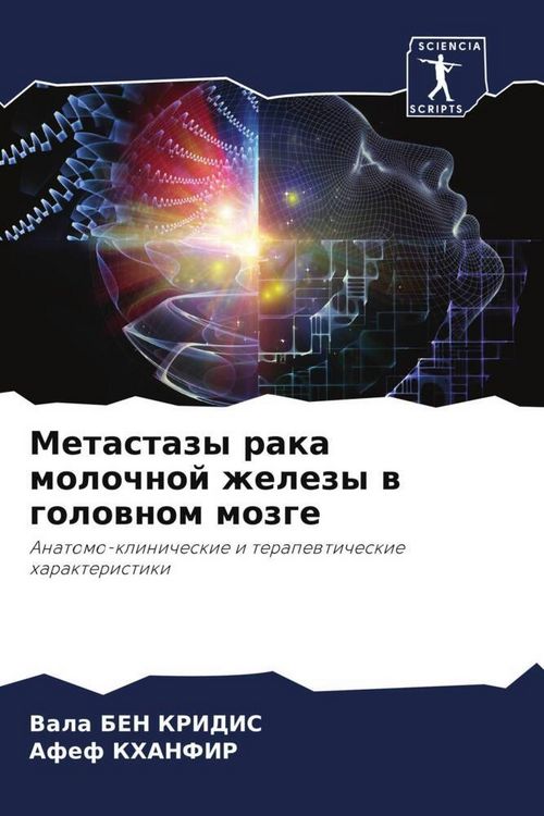 Produktbild: Metastazy raka molochnoj zhelezy w golownom mozge