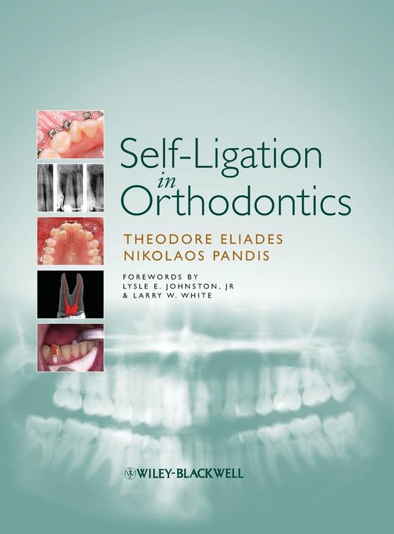 Produktbild: Self-Ligation in Orthodontics