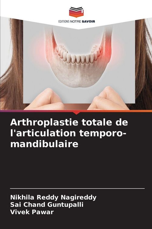 Produktbild: Arthroplastie totale de l'articulation temporo-mandibulaire
