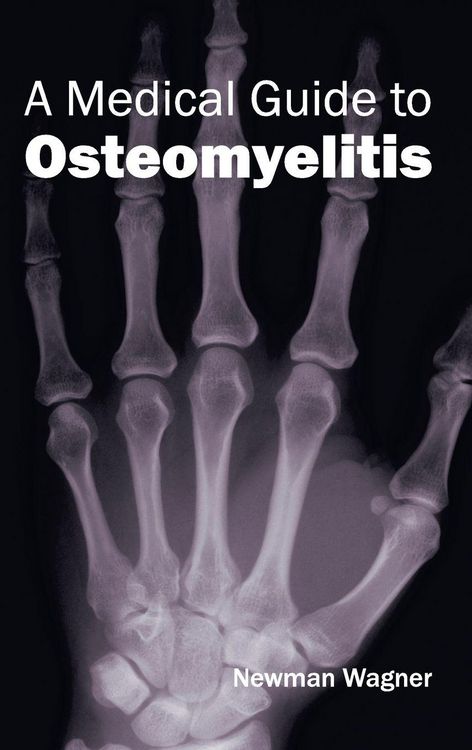 Produktbild: A Medical Guide to Osteomyelitis