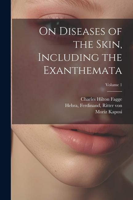 Produktbild: On Diseases of the Skin, Including the Exanthemata; Volume 1