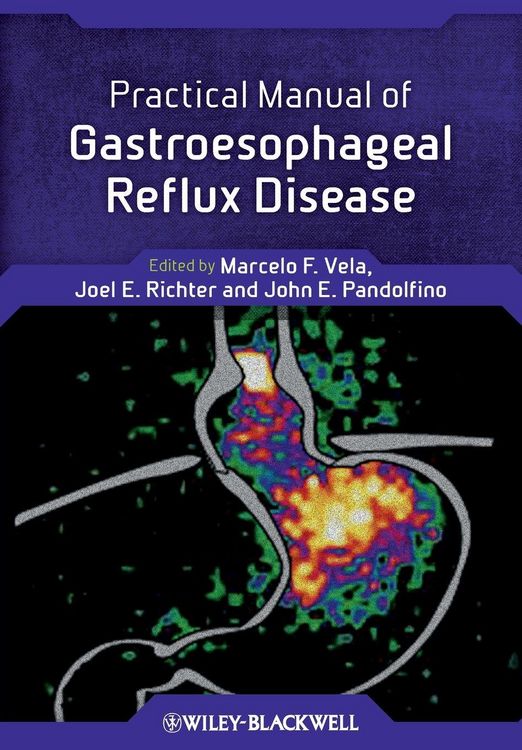 Produktbild: Practical Manual of Gastroesophageal Reflux Disease