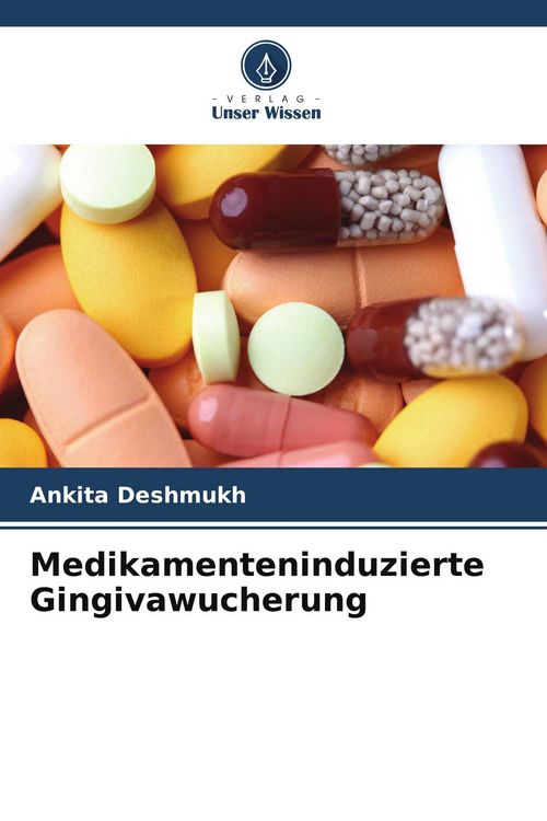Produktbild: Medikamenteninduzierte Gingivawucherung