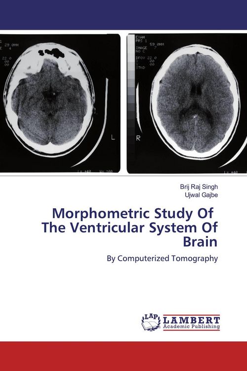 Produktbild: Morphometric Study Of The Ventricular System Of Brain