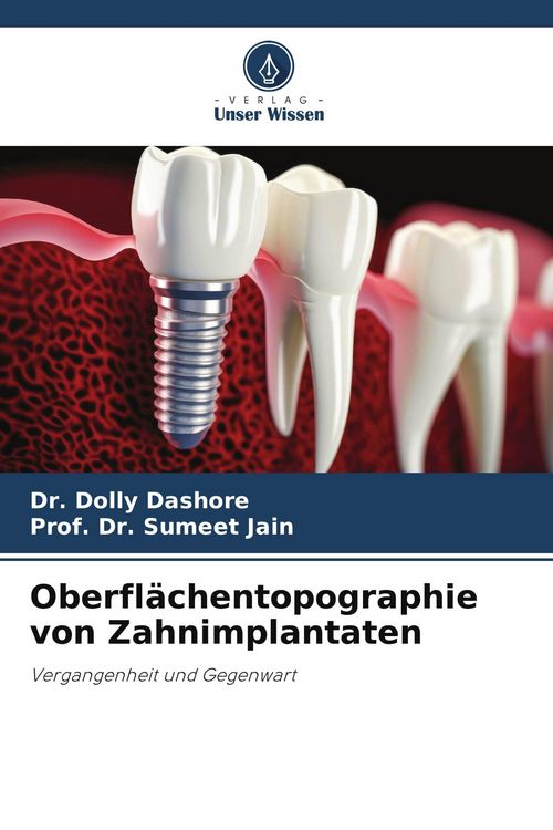 Produktbild: Oberfl&auml;chentopographie von Zahnimplantaten