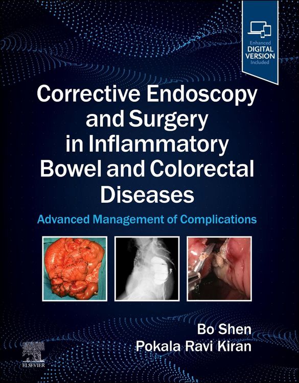 Produktbild: Corrective Endoscopy and Surgery in Inflammatory Bowel and Colorectal Diseases