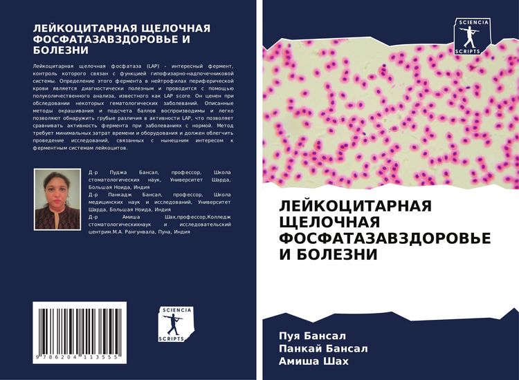 Produktbild: LEJKOCITARNAYa ShhELOChNAYa FOSFATAZAVZDOROV'E I BOLEZNI