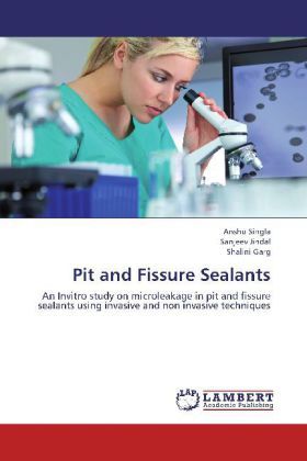 Produktbild: Singla, A: Pit and Fissure Sealants