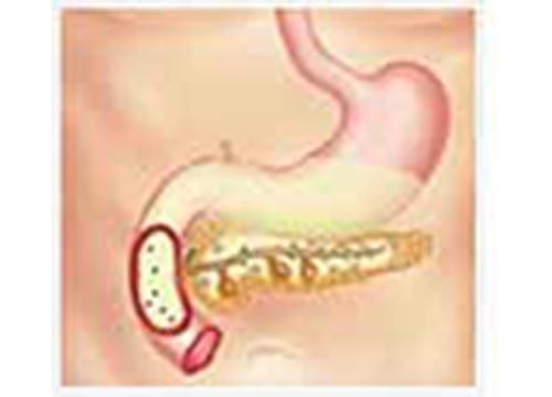 Produktbild: Pancreatic Function Test Part 1