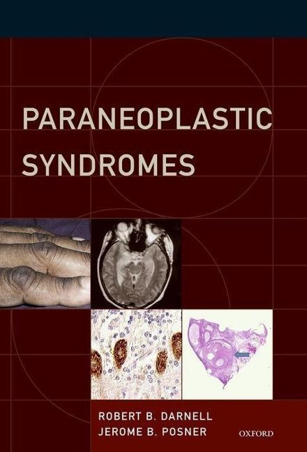 Produktbild: Paraneoplastic Syndromes