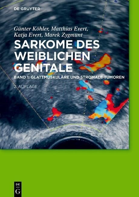 Produktbild: Glattmuskul&auml;re und stromale Tumoren
