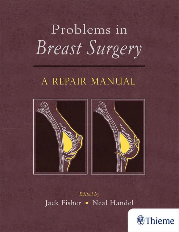Produktbild: Problems in Breast Surgery
