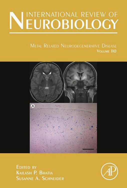 Produktbild: Metal Related Neurodegenerative Disease