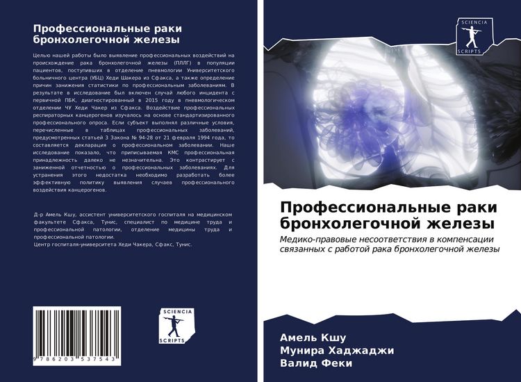 Produktbild: Professional'nye raki bronholegochnoj zhelezy