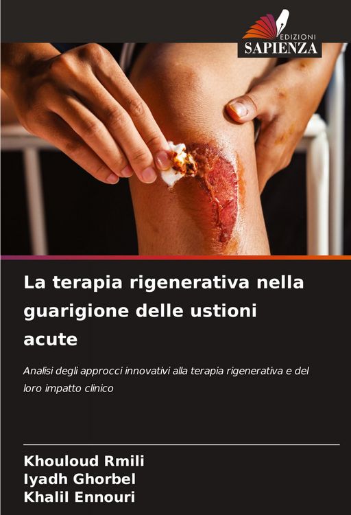 Produktbild: La terapia rigenerativa nella guarigione delle ustioni acute