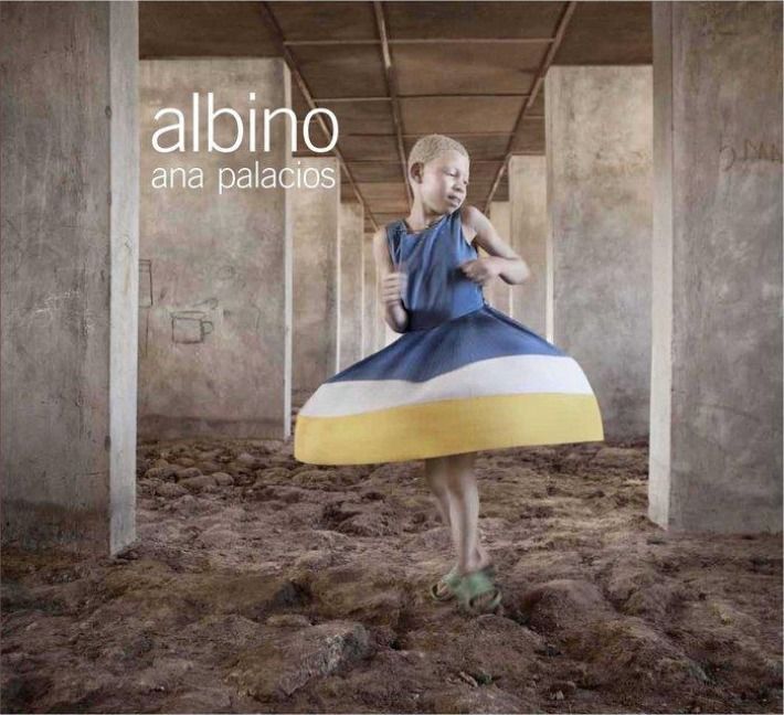 Produktbild: Albino