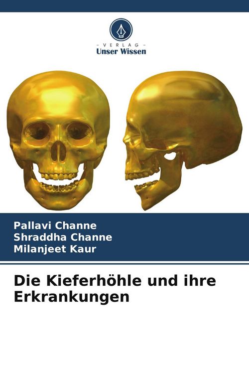 Produktbild: Die Kieferh&ouml;hle und ihre Erkrankungen