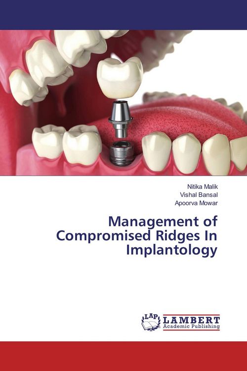 Produktbild: Management of Compromised Ridges In Implantology
