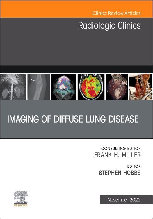 Produktbild: Imaging of Diffuse Lung Disease, an Issue of Radiologic Clinics of North America