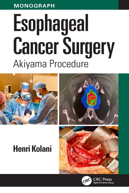 Produktbild: Esophageal Cancer Surgery