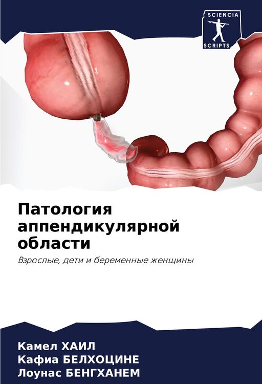Produktbild: Patologiq appendikulqrnoj oblasti