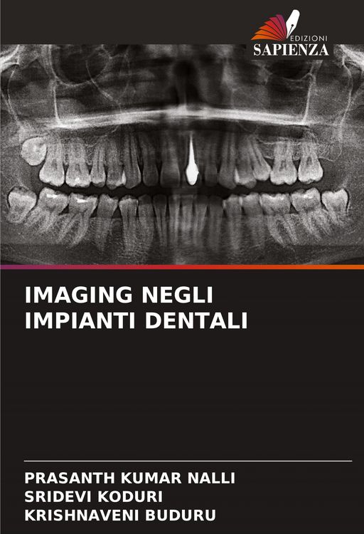 Produktbild: Imaging Negli Impianti Dentali