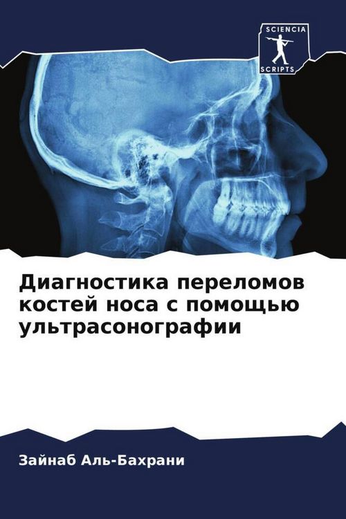 Produktbild: Diagnostika perelomow kostej nosa s pomosch'&uuml; ul'trasonografii