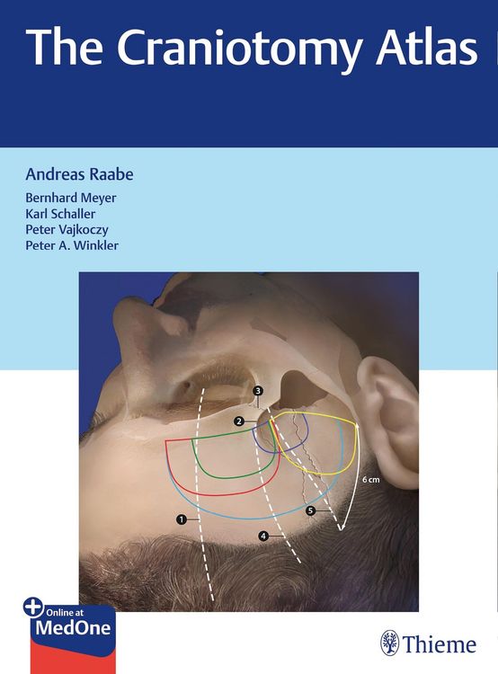 Produktbild: The Craniotomy Atlas