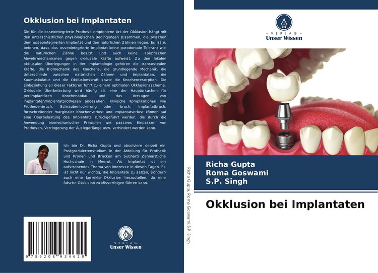 Produktbild: Okklusion bei Implantaten