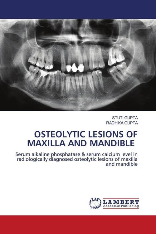 Produktbild: Osteolytic Lesions Of Maxilla and Mandible