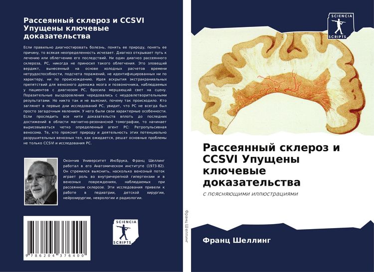 Produktbild: Rasseqnnyj skleroz i CCSVI Upuscheny kl&uuml;chewye dokazatel'stwa