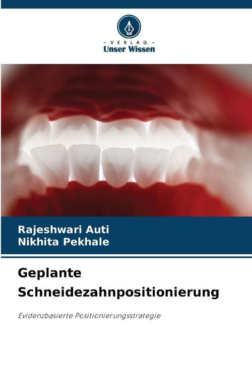 Produktbild: Geplante Schneidezahnpositionierung