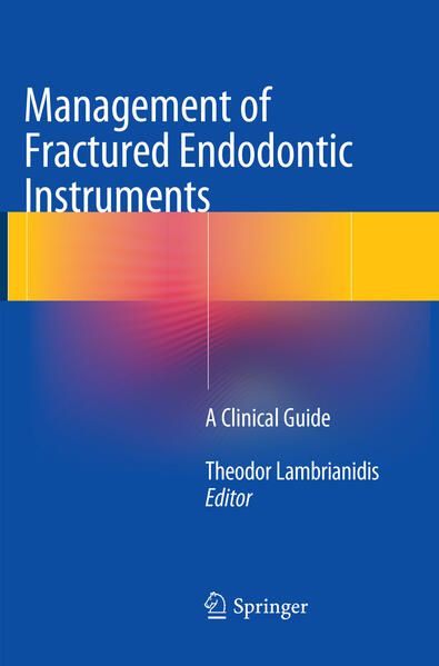 Produktbild: Management of Fractured Endodontic Instruments