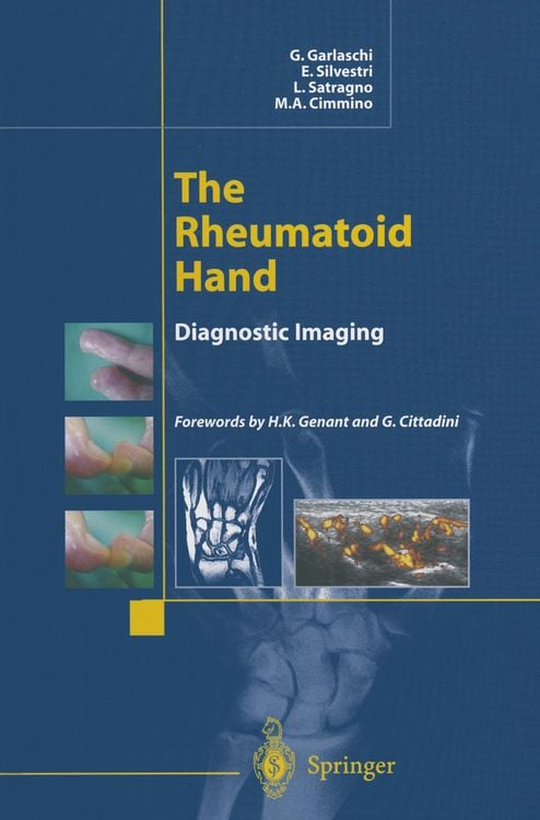 Produktbild: The Rheumatoid Hand