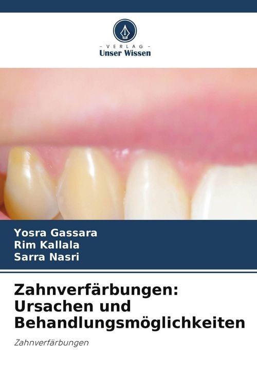 Produktbild: Zahnverf&auml;rbungen: Ursachen und Behandlungsm&ouml;glichkeiten