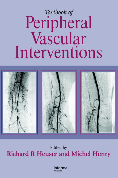 Produktbild: Textbook of Peripheral Vascular Interventions