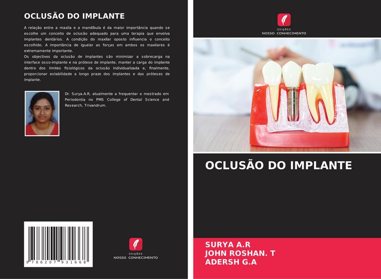 Produktbild: OCLUS&Atilde;O DO IMPLANTE