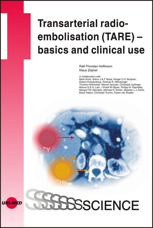 Produktbild: Transarterial radioembolisation (TARE) - basics and clinical use
