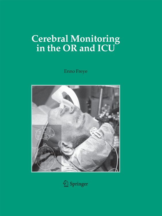 Produktbild: Cerebral Monitoring in the OR and ICU