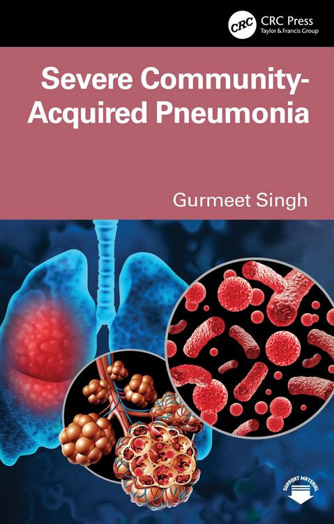 Produktbild: Severe Community-Acquired Pneumonia