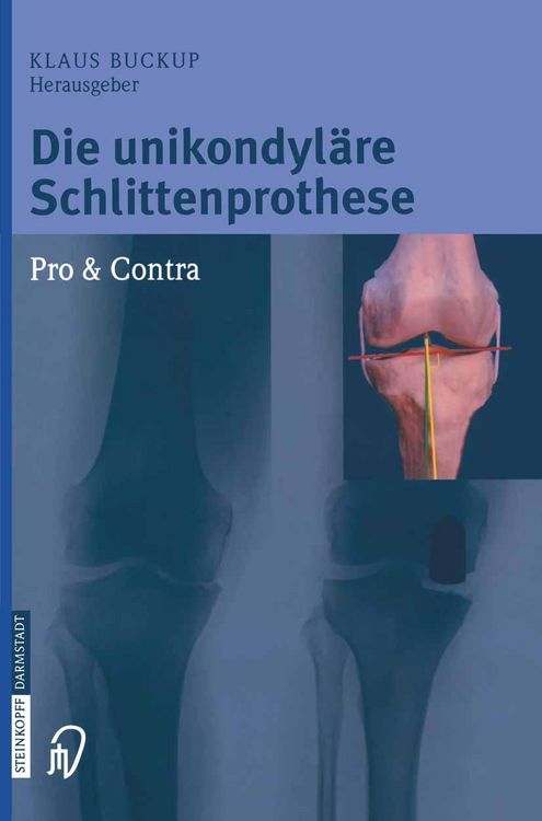 Produktbild: Die unikondyl&auml;re Schlittenprothese Pro & Contra