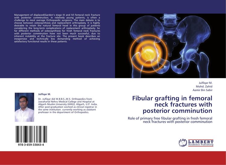 Produktbild: Fibular grafting in femoral neck fractures with posterior comminution