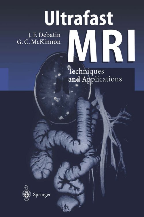 Produktbild: Ultrafast MRI