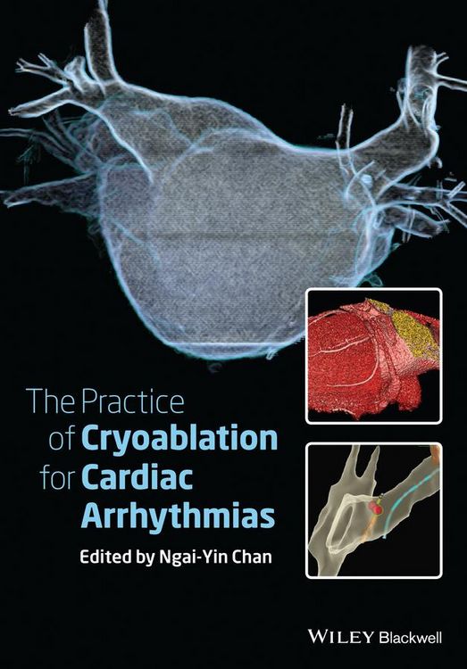 Produktbild: The Practice of Catheter Cryoablation for Cardiac Arrhythmias