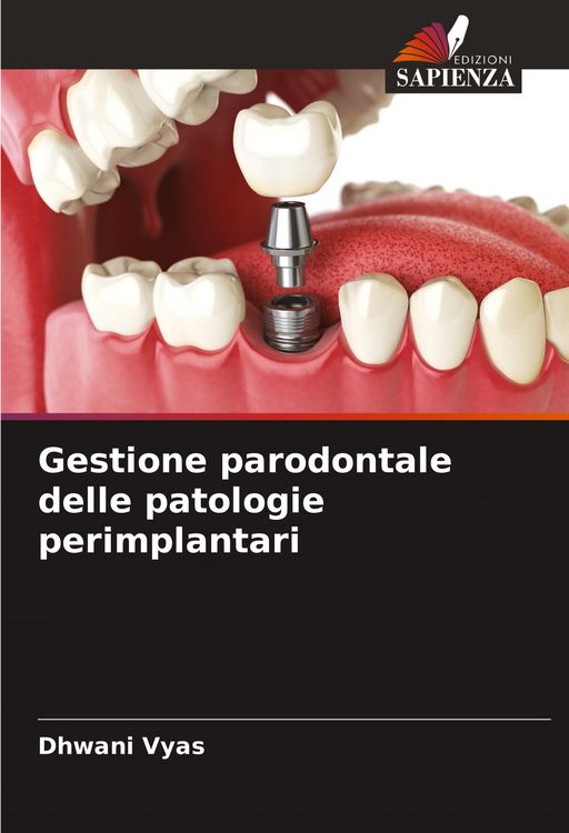 Produktbild: Gestione parodontale delle patologie perimplantari