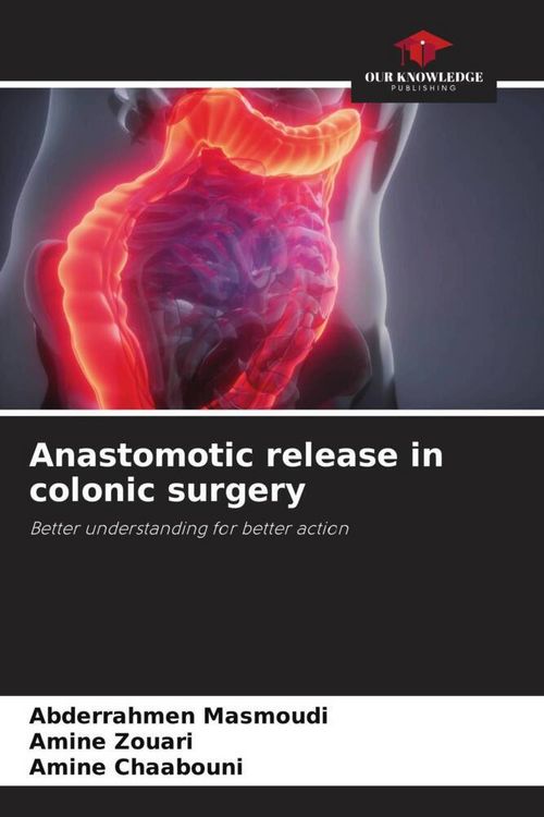 Produktbild: Anastomotic release in colonic surgery